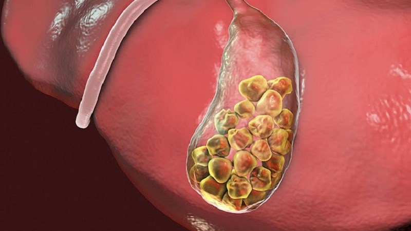 Lúa mạch giúp giảm cholesterol