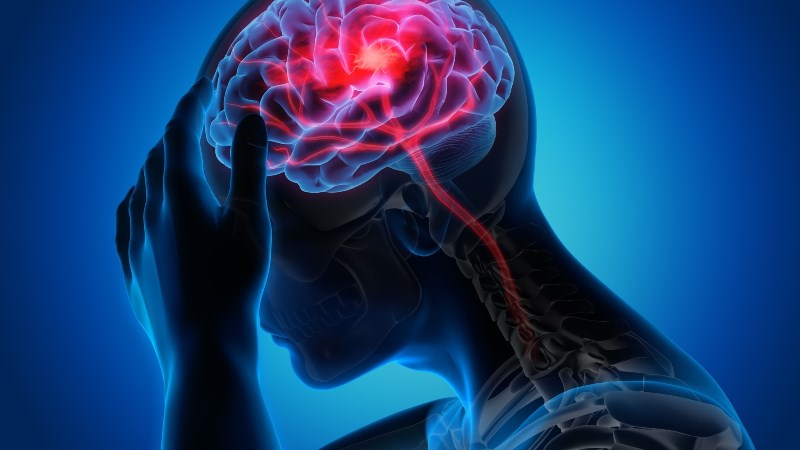Cải thiện tình trạng đau nửa đầu