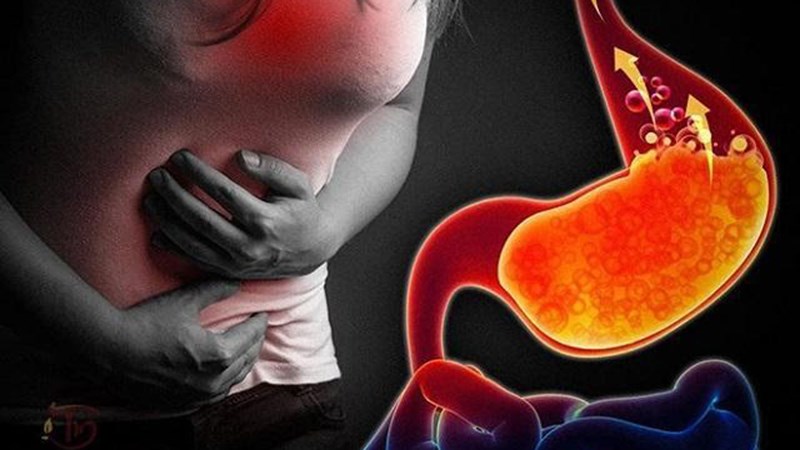 Giảm trào ngược dạ dày thực quản