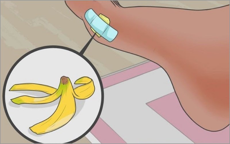 Lấy dằm ra khỏi tay