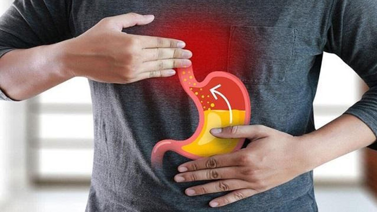 Trào ngược dạ dày nên ăn gì? Cách làm giảm trào ngược dạ dày