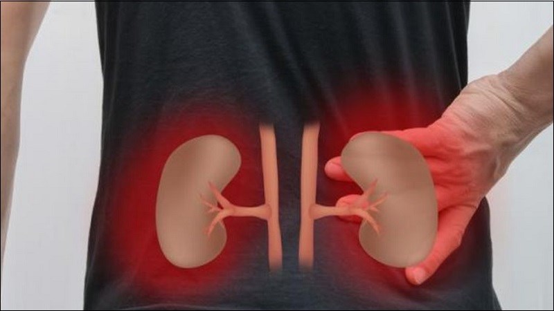 Ngăn ngừa sự xuất hiện của sỏi thận