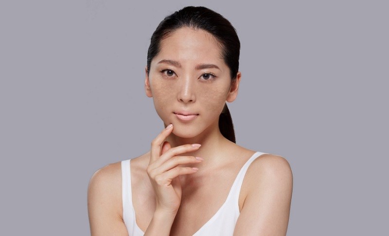 Cải thiện sắc tố da