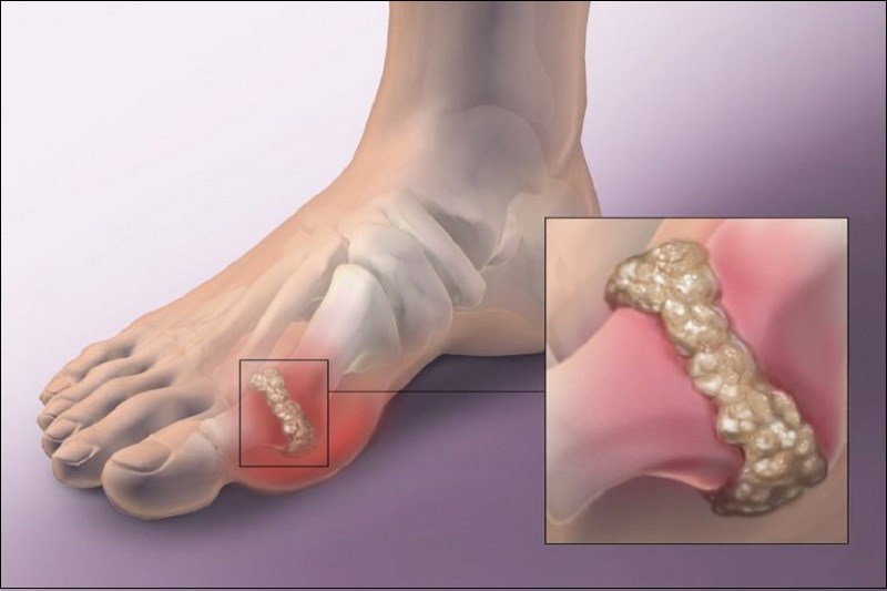 Giúp chữa lành các bệnh và tình trạng viêm