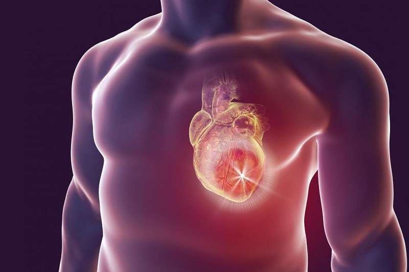 Giảm nhẹ hội chứng chuyển hóa