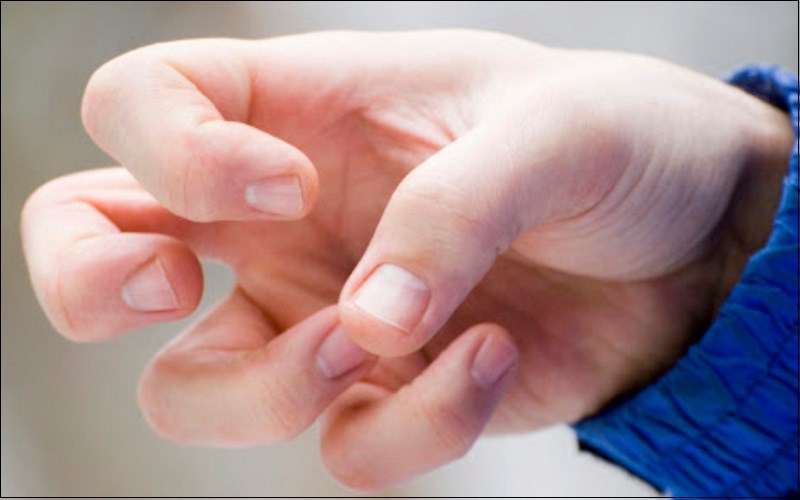 Giảm co giật ở người động kinh