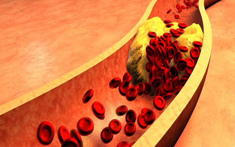 Giúp giảm Cholesterol