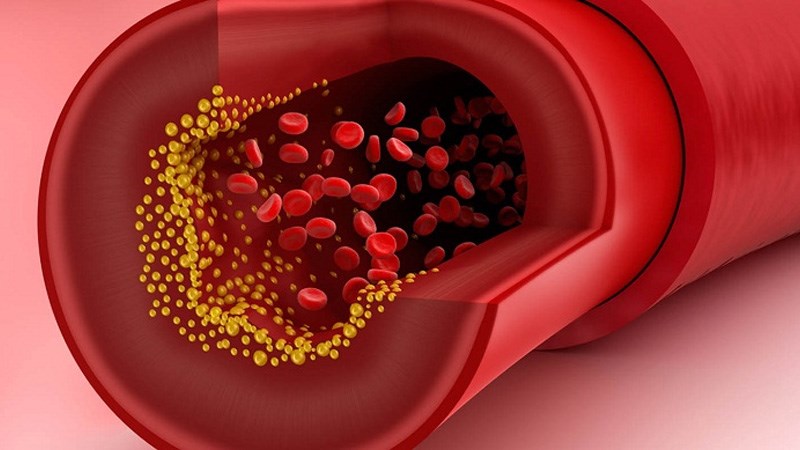 cholesterol