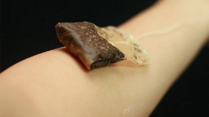 Làm dịu vết côn trùng cắn bằng túi trà