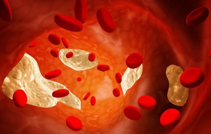 Tăng HDL, bảo vệ LDL khỏi quá trình oxy hóa