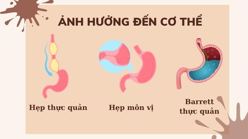 Ăn không tiêu có thể gây ra các biến chứng nếu không điều trị kịp thời