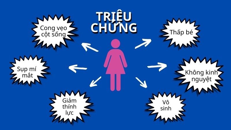 Một số triệu chứng thường gặp của hội chứng Turner