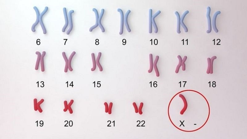 Phân tích cấu trúc bộ nhiễm sắc thể để đưa ra kết luận chính xác