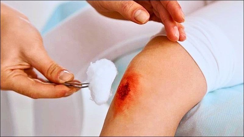Bệnh suy dinh dưỡng có thể làm rối loạn hệ thống miễn dịch khiến các vết thương dễ bị nhiễm trùng nặng