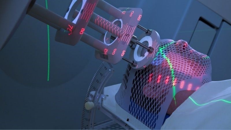 Dùng tia năng lượng cao để tiêu diệt tế bào