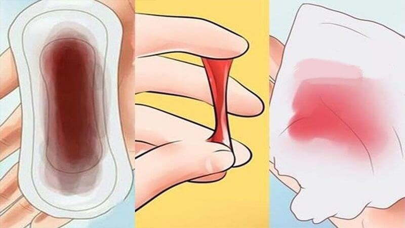 Chảy máu âm đạo là triệu chứng thường gặp khi nhiễm chlamydia Chảy máu âm đạo là triệu chứng thường gặp khi nhiễm chlamydia