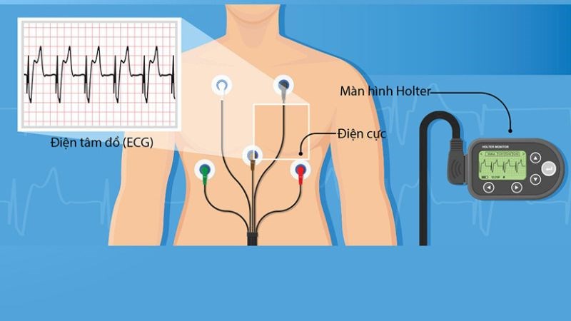 Sử dụng điện tâm đồ để đánh giá nhịp tim