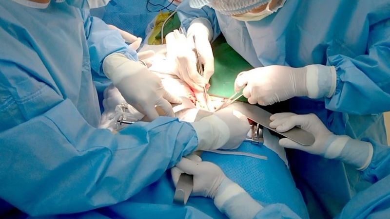 Thực hiện phẫu thuật khi mạch máu bị vỡ hoặc tắc nghẽn