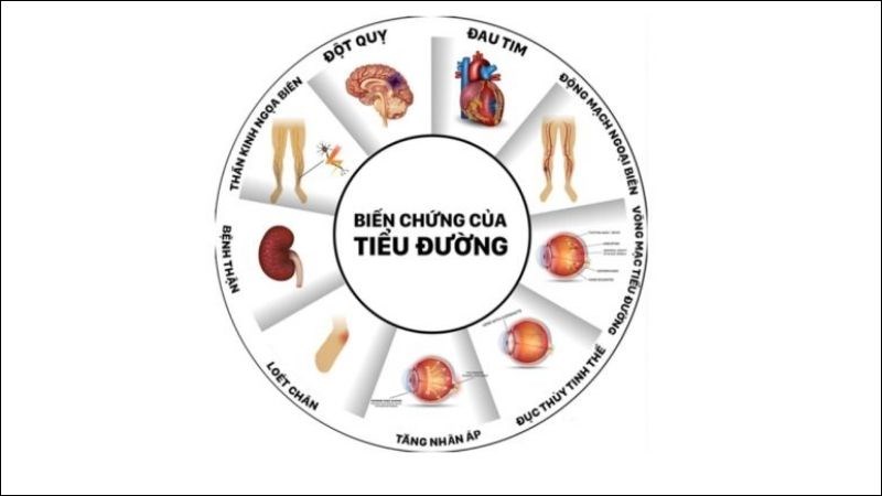 Đái tháo đường là một trong những nguyên nhân gây ra glocom thứ phát