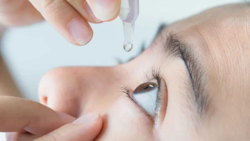 Nhỏ mắt thường xuyên giúp phòng ngừa các đợt glocom cấp tính