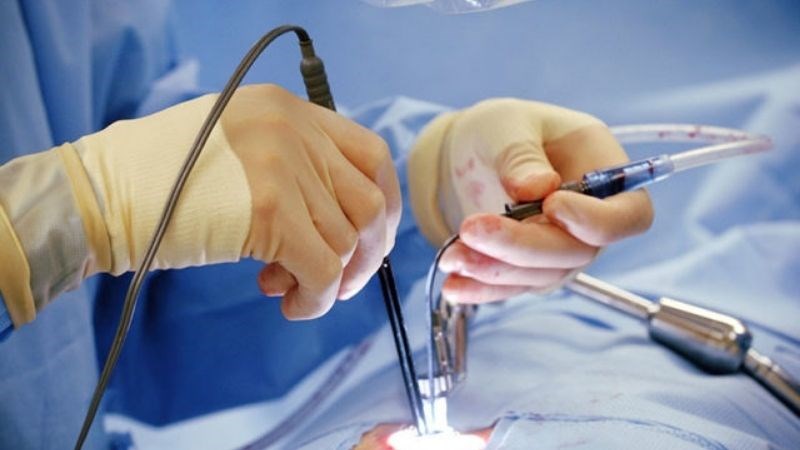 Thực hiện các phương pháp phẫu thuật để điều trị rối loạn nhịp tim
