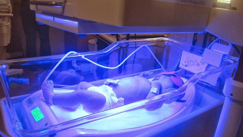 Chiếu đèn là biện pháp điều trị vàng da đơn giản và phổ biến Chiếu đèn là biện pháp điều trị vàng da đơn giản và phổ biến