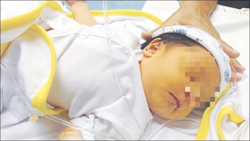 Bất kỳ dấu hiệu vàng da bất thường đều là vàng da bệnh lý Bất kỳ dấu hiệu vàng da bất thường đều là vàng da bệnh lý