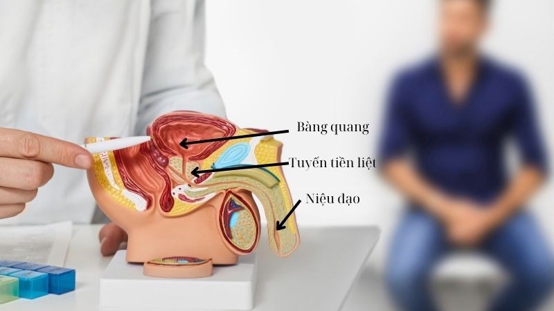 Đa phần nguyên nhân gây bệnh là do vi khuẩn