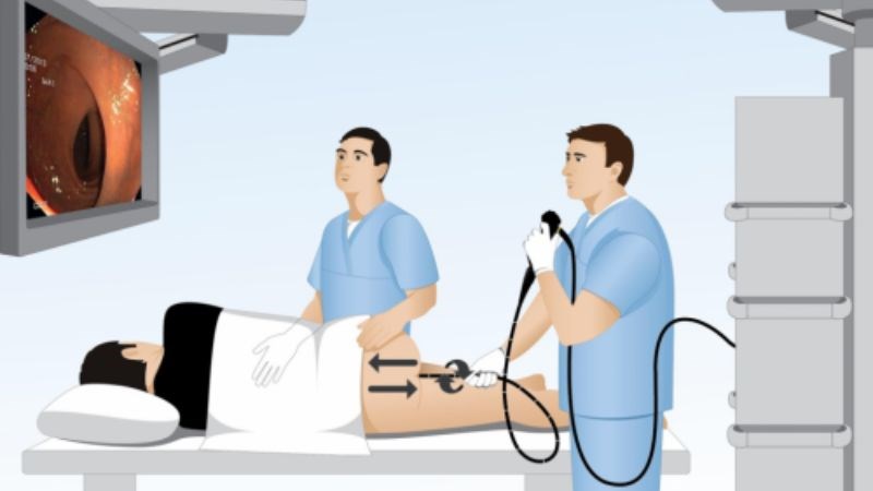 Bác sĩ có thể thực hiện soi trực tràng khi áp xe không nằm trên bề mặt da hoặc nằm sâu hơn trong da