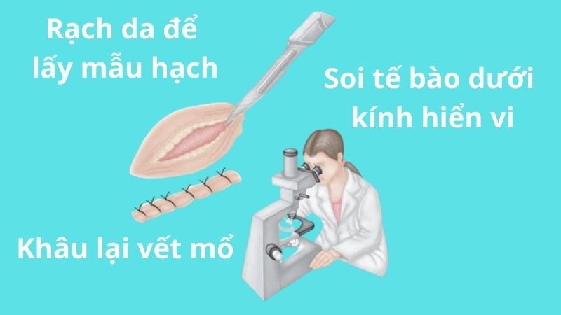 Sinh thiết hạch để đánh giá cấu trúc hạch