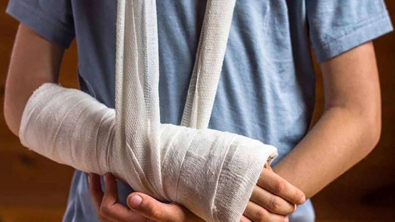 Dùng bó bột để cố định vùng bị thương