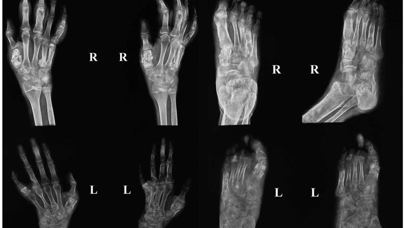 Các biện pháp chẩn đoán hình ảnh giúp quan sát và đánh giá được tình trạng của xương