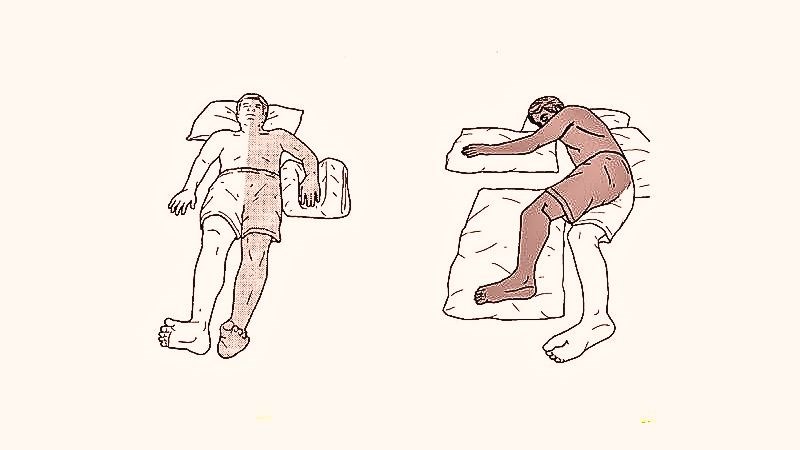 Liệt nửa người là tình trạng một nửa cơ thể không thể vận động