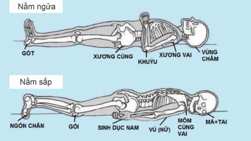 Các vị trí da dễ bị loét tương ứng với các tư thế