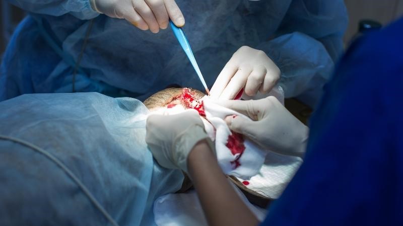 Phẫu thuật được áp dụng đối với trường hợp bệnh meniere nghiêm trọng