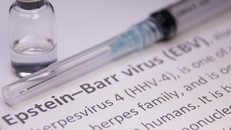 Nhiễm Epstein barr virus làm tăng nguy cơ mắc bệnh meniere