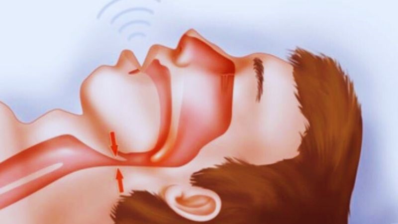 Khi ngủ ngáy hoặc ngưng thở khi ngủ nên đến các cơ sở y tế Khi ngủ ngáy hoặc ngưng thở khi ngủ nên đến các cơ sở y tế