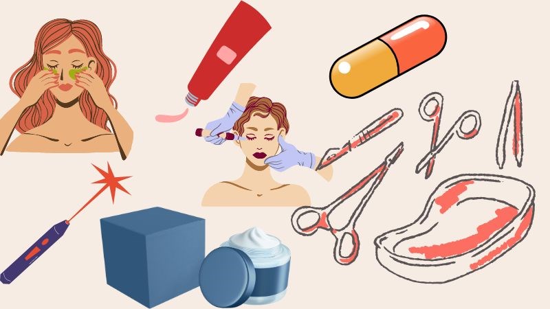 Điều trị bằng thuốc hoặc phẫu thuật sẽ cải thiện được tình trạng bệnh rosacea Điều trị bằng thuốc hoặc phẫu thuật sẽ cải thiện được tình trạng bệnh rosacea