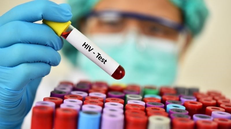 HIV có thể là nguyên nhân gây suy sinh dục ở nam giới