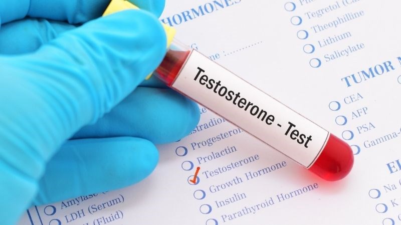 Định lượng testosterone trong máu giúp xác định mức độ nghiêm trọng của bệnh