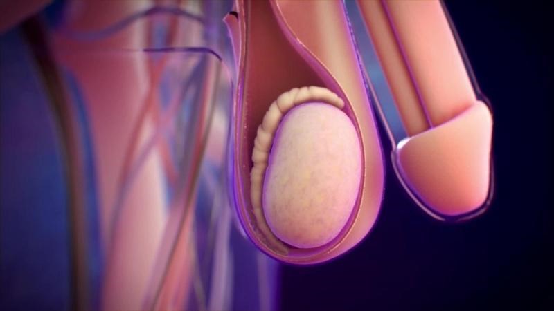 Viêm tinh hoàn do quai bị có khả năng gây teo tinh hoàn dẫn đến vô sinh Viêm tinh hoàn do quai bị có khả năng gây teo tinh hoàn dẫn đến vô sinh