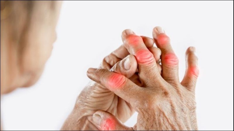Các ngón tay sưng đỏ là biểu hiện của bệnh tự miễn Các ngón tay sưng đỏ là biểu hiện của bệnh tự miễn
