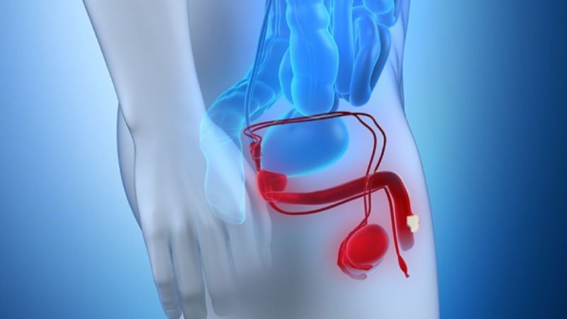 Ung thư dương vật thường gặp hay gặp nhất là ở những người bị hẹp bao quy đầu