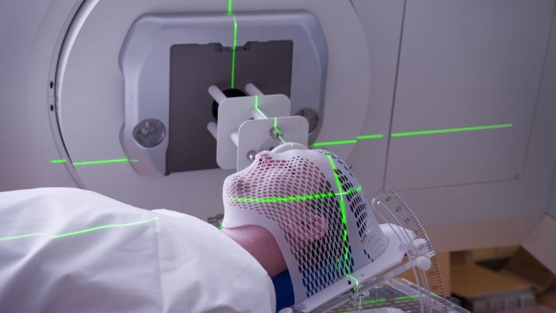 Sử dụng tia xạ để phá hủy tế bào ung thư vùng mũi xoang