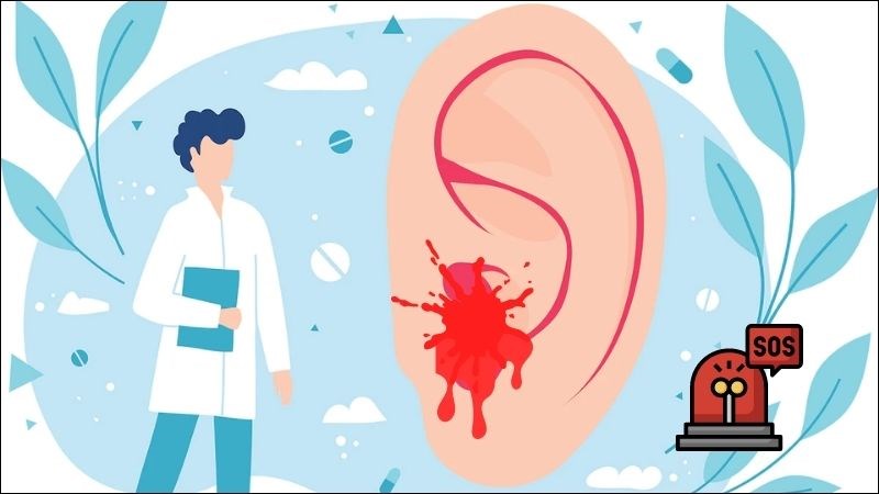 Hãy đi khám bác sĩ ngay bất kỳ khi nào bạn bị chảy máu tai