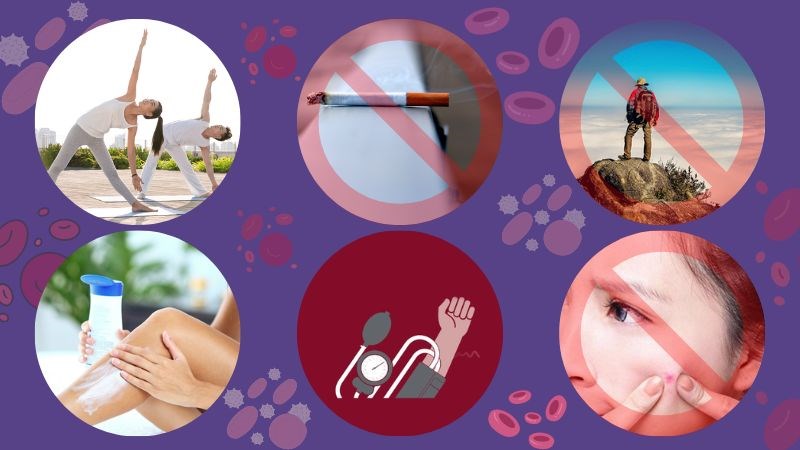 Bệnh nhân đa hồng cầu nguyên phát cần lưu ý những điều này để tự chăm sóc tại nhà Bệnh nhân đa hồng cầu nguyên phát cần lưu ý những điều này để tự chăm sóc tại nhà