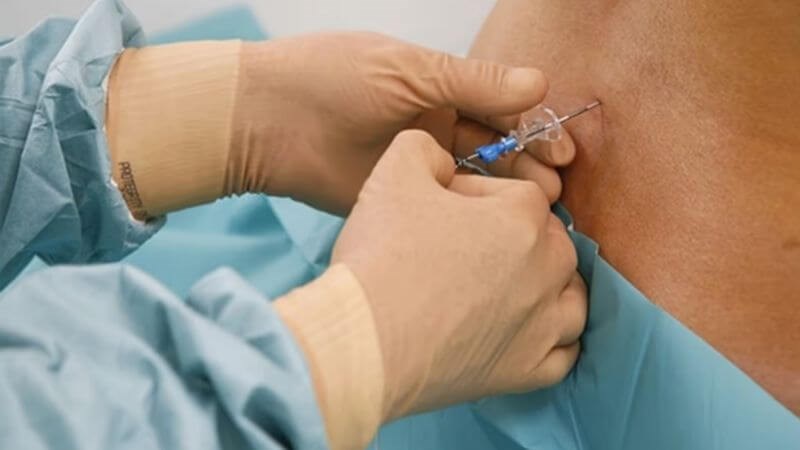 Kiểm tra tủy xương giúp phát hiện các khối u Kiểm tra tủy xương giúp phát hiện các khối u