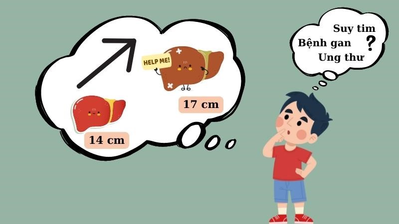 Gan to có thể là triệu chứng của một số bệnh lý tiềm ẩn