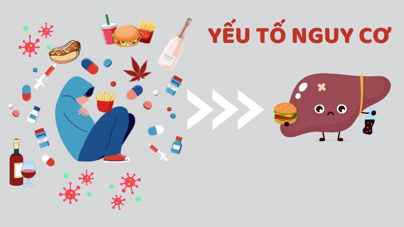 Khả năng bị gan to sẽ cao hơn nếu bạn có các yếu tố nguy cơ