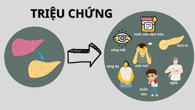 Gan to có các triệu chứng dễ nhận biết trên da, mắt hay nước tiểu